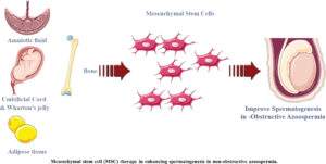 stem cell and azoospermia