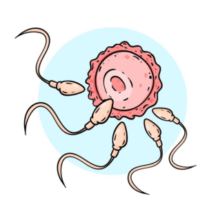 Non-obstructive azoospermia