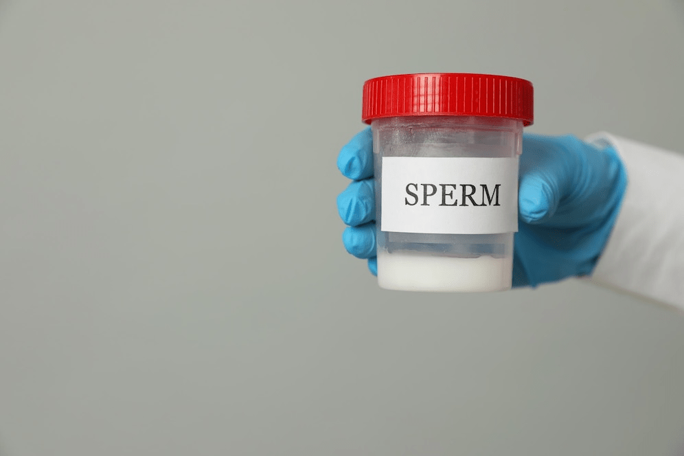 Zero sperm confirmation after vasectomy